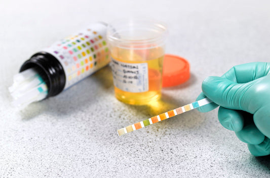Should Employees be tested for Drugs and Alcohol?
