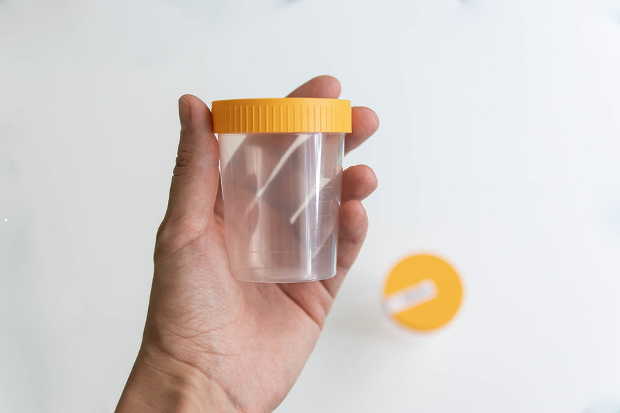 How Long Does a Urine Drug Test Take?