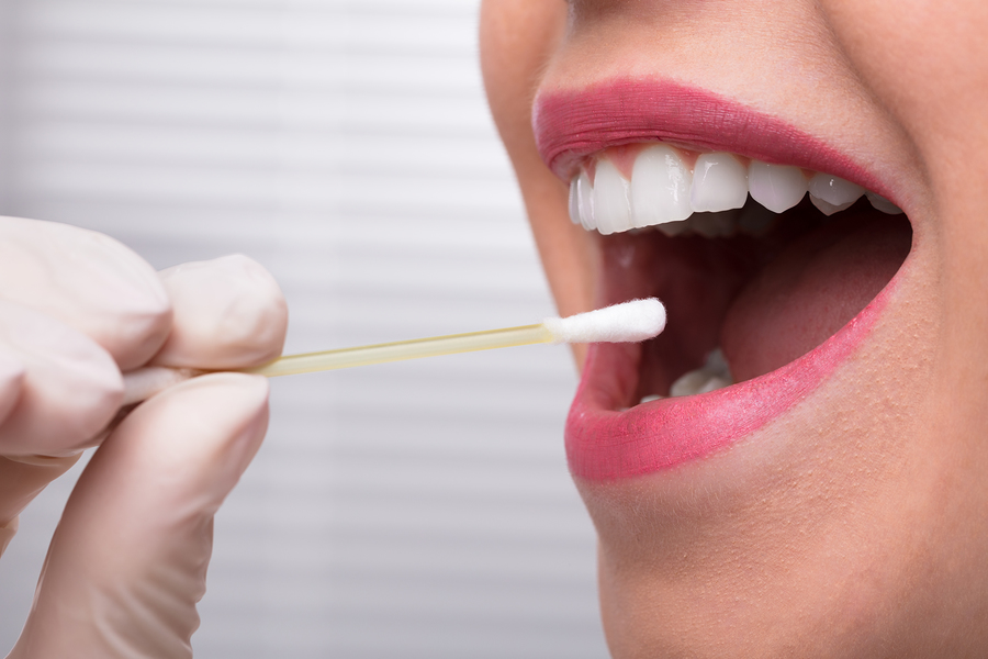 Are Saliva Tests as Effective as Urine Drug Tests?