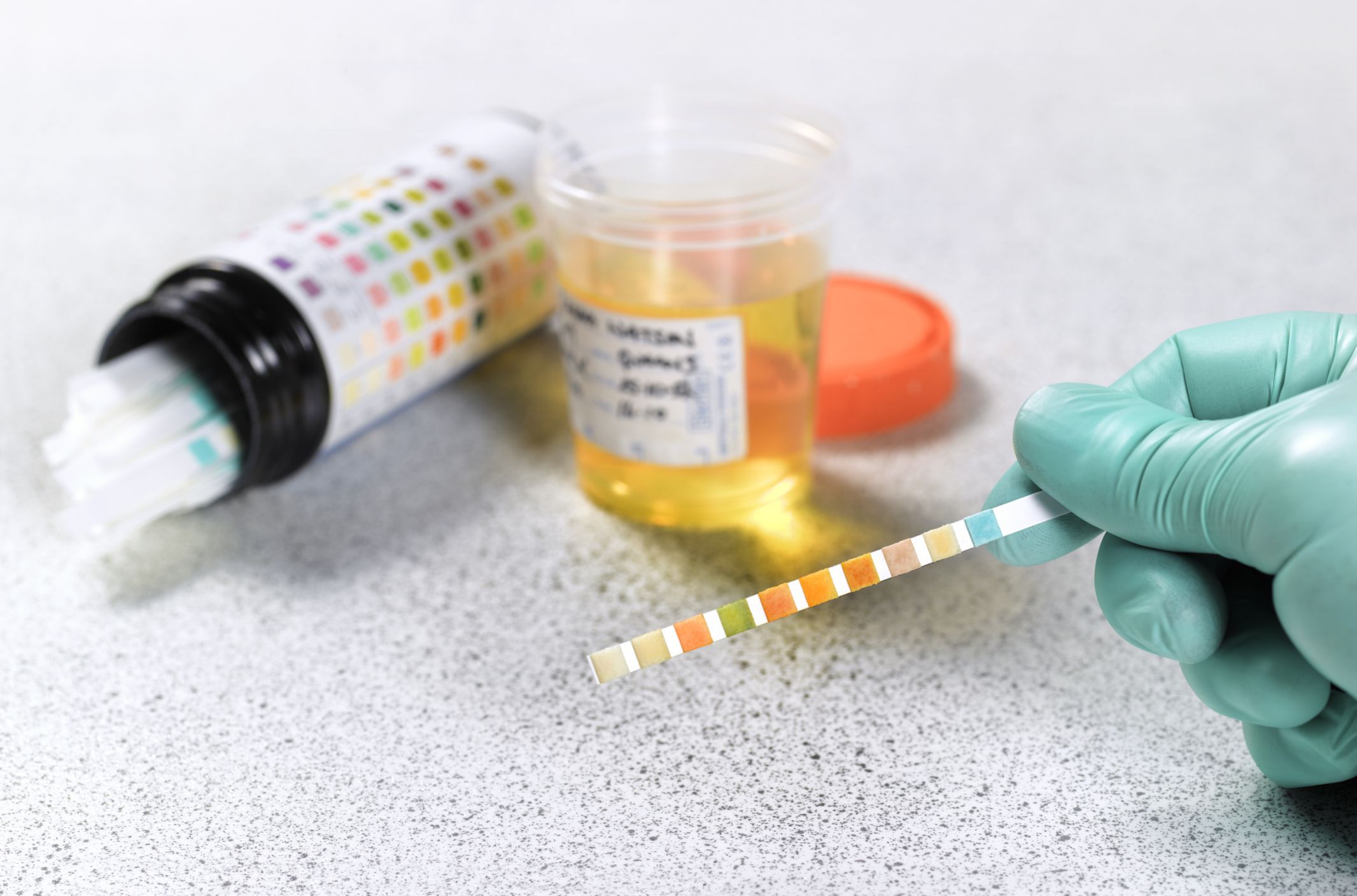 Should Drug Testing  Be Mandatory?